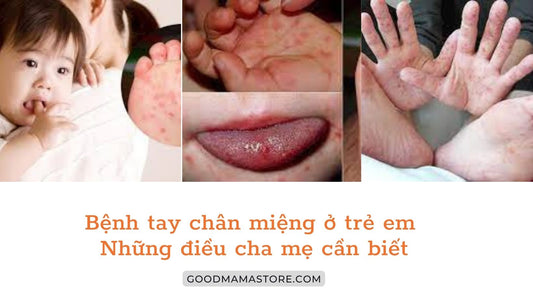 Bệnh tay chân miệng ở trẻ em – Những điều cha mẹ cần biết