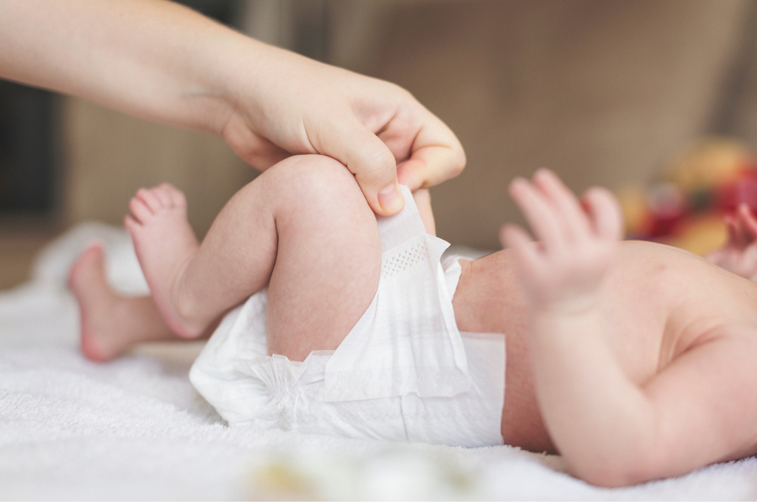 Có nên đóng bỉm 24/24 cho trẻ sơ sinh không?