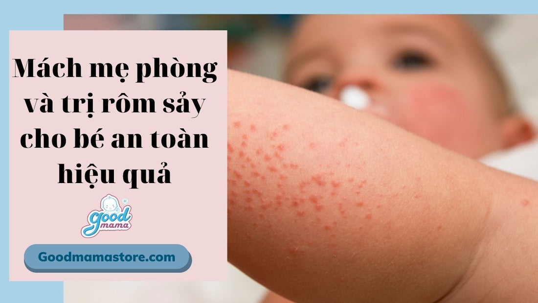 Mách mẹ phòng và trị rôm sảy cho bé an toàn và hiệu quả