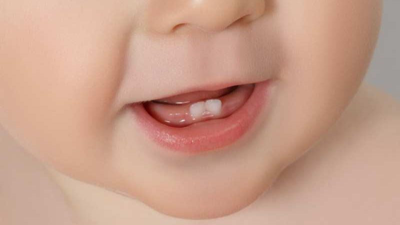 Trẻ chậm mọc răng có phải thiếu canxi? Nguyên nhân – Hậu quả – Giải pháp toàn diện mẹ cần biết